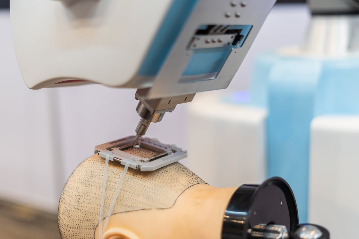 Equipamento de transplante capilar automático em procedimento clínico